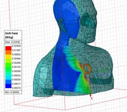Implant Charging SAR Analysis